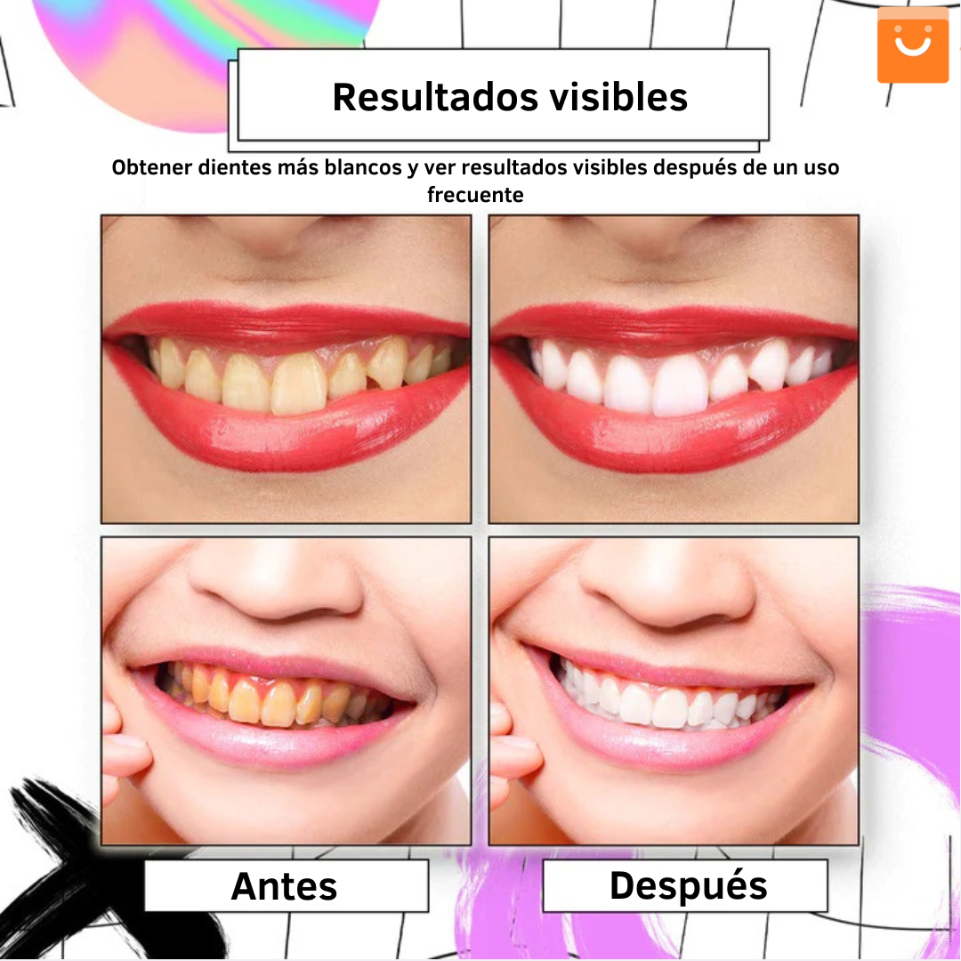 ⚡ Oferta Flash |  AngelSmile™- Pasta de dientes en mousse morada blanqueadora