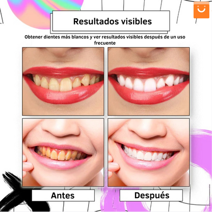 ⚡ Oferta Flash |  AngelSmile™- Pasta de dientes en mousse morada blanqueadora