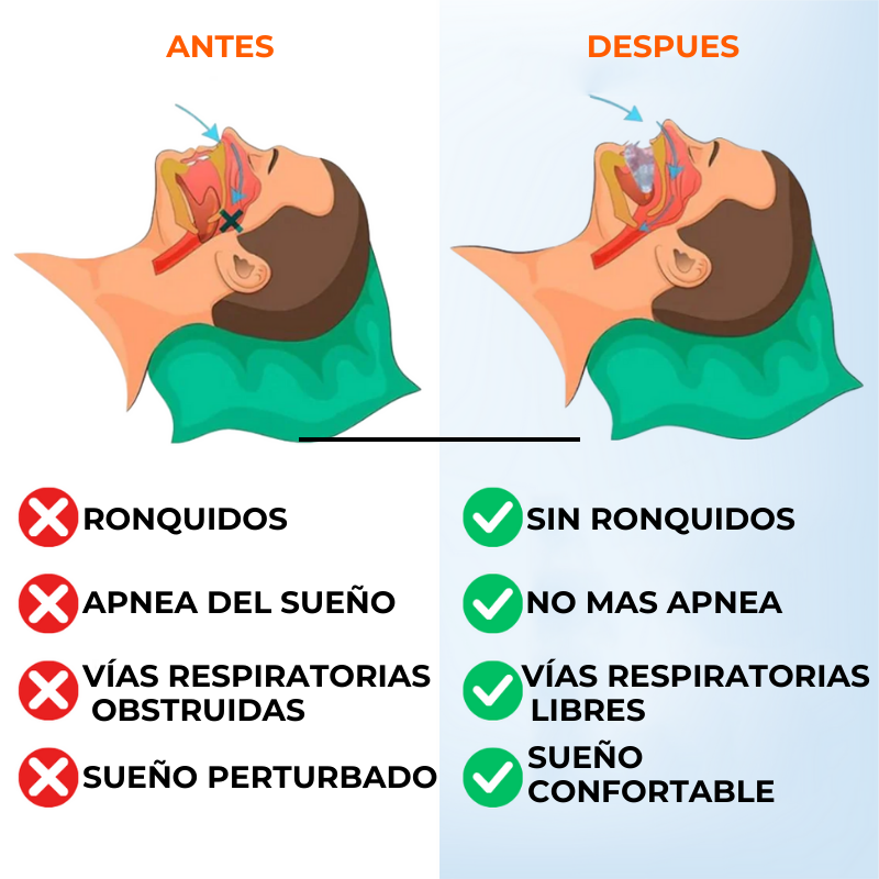 SleepPro™ - Protector bucal antironquidos