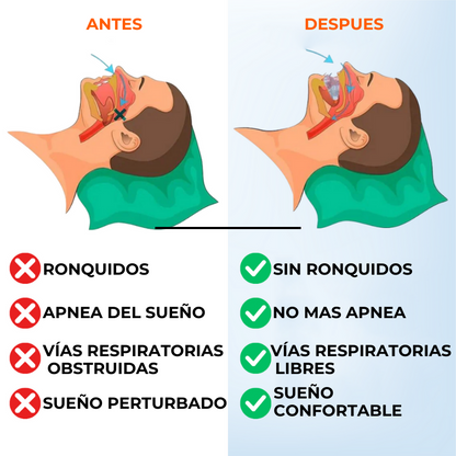 SleepPro™ - Protector bucal antironquidos