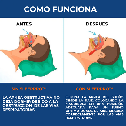 SleepPro™ - Protector bucal antironquidos