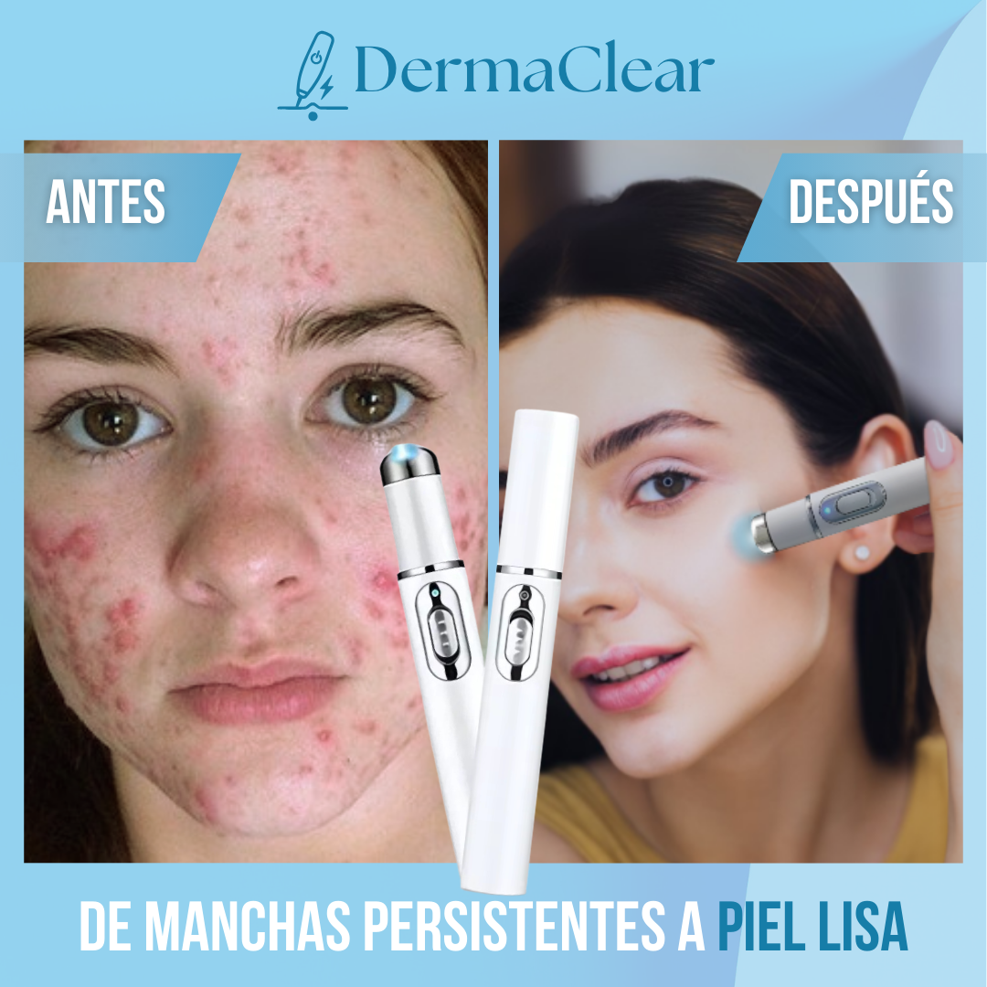 DermaClear™ – Borra imperfecciones al instante