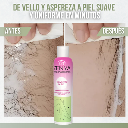ZENYA™ - Piel suave, depilación fácil y resultados que duran.