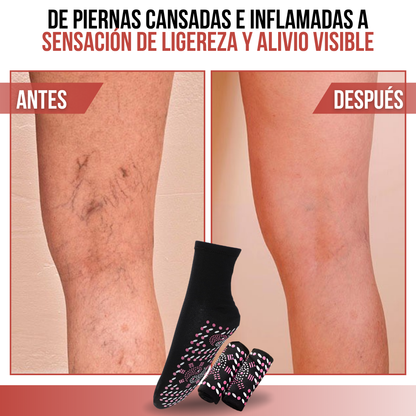 AcuStep™ - Piernas ligeras, vida sin límites