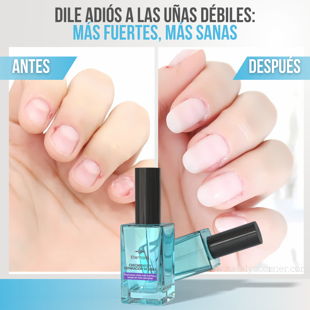 ETERNAIL™ - Uñas más fuertes, sanas y largas desde la primera aplicación