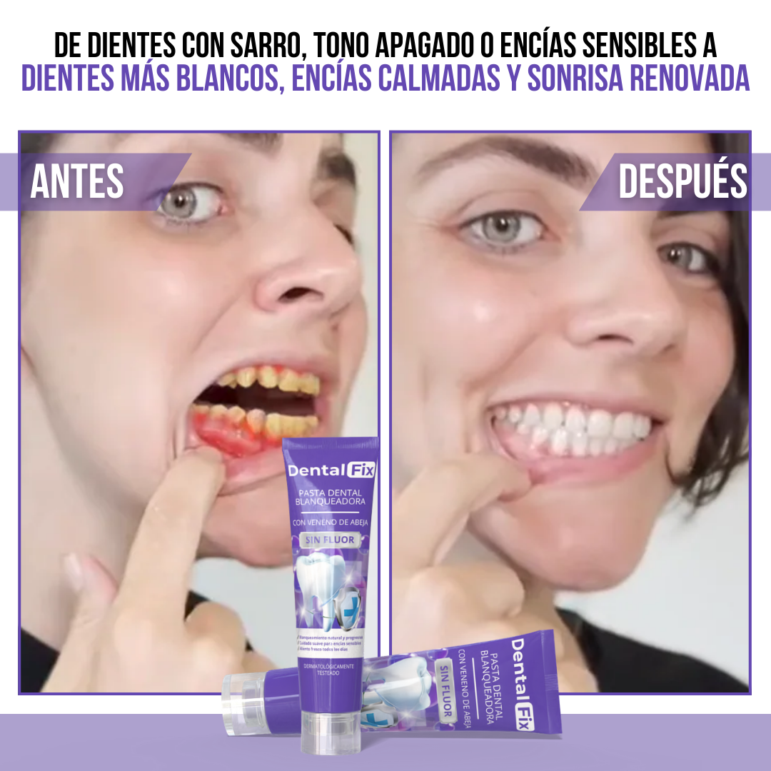 Dental Fix™ - Una sonrisa más blanca, cuidada de forma natural