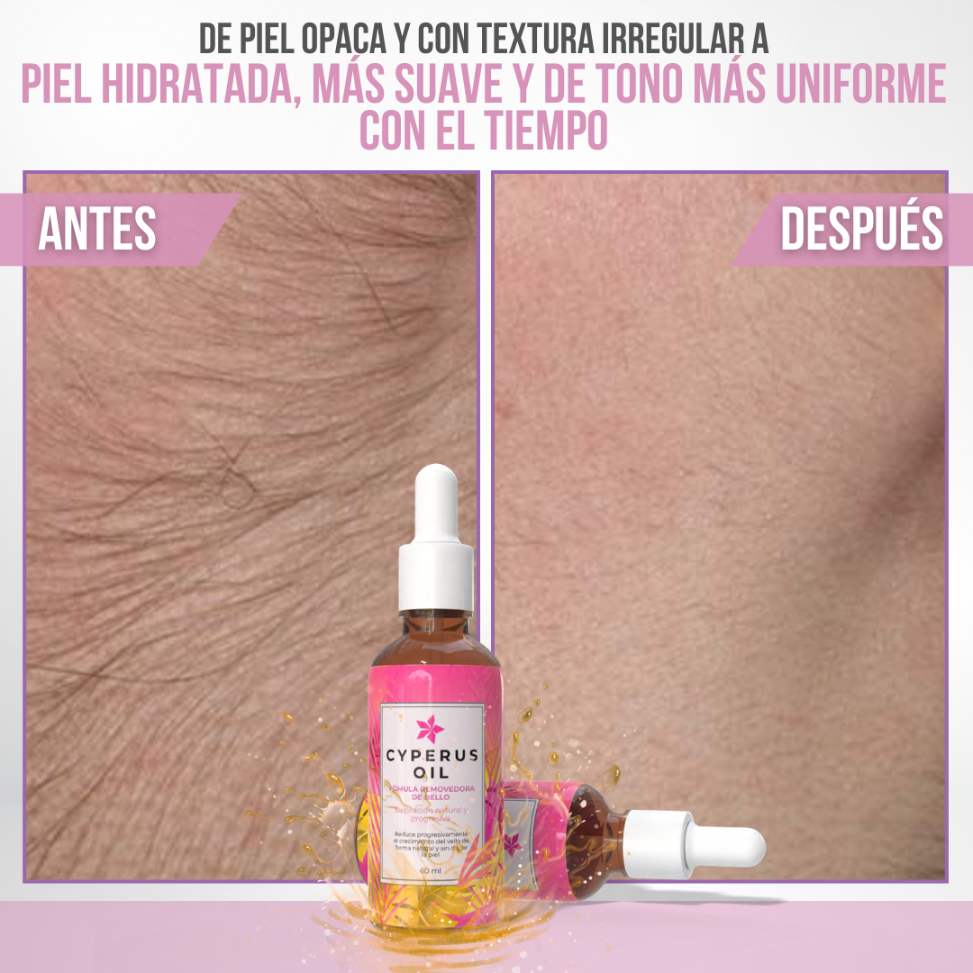 Cyperus Oil™ — Menos vello, más piel. Naturalmente