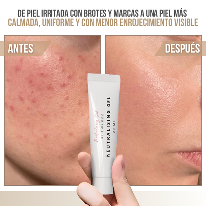 Neutralising Gel™ — Controla los brotes hoy, cuida tu piel a largo plazo