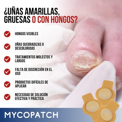 MycoPatch™ - Recupera tus uñas con la fuerza de la ciencia y la naturaleza