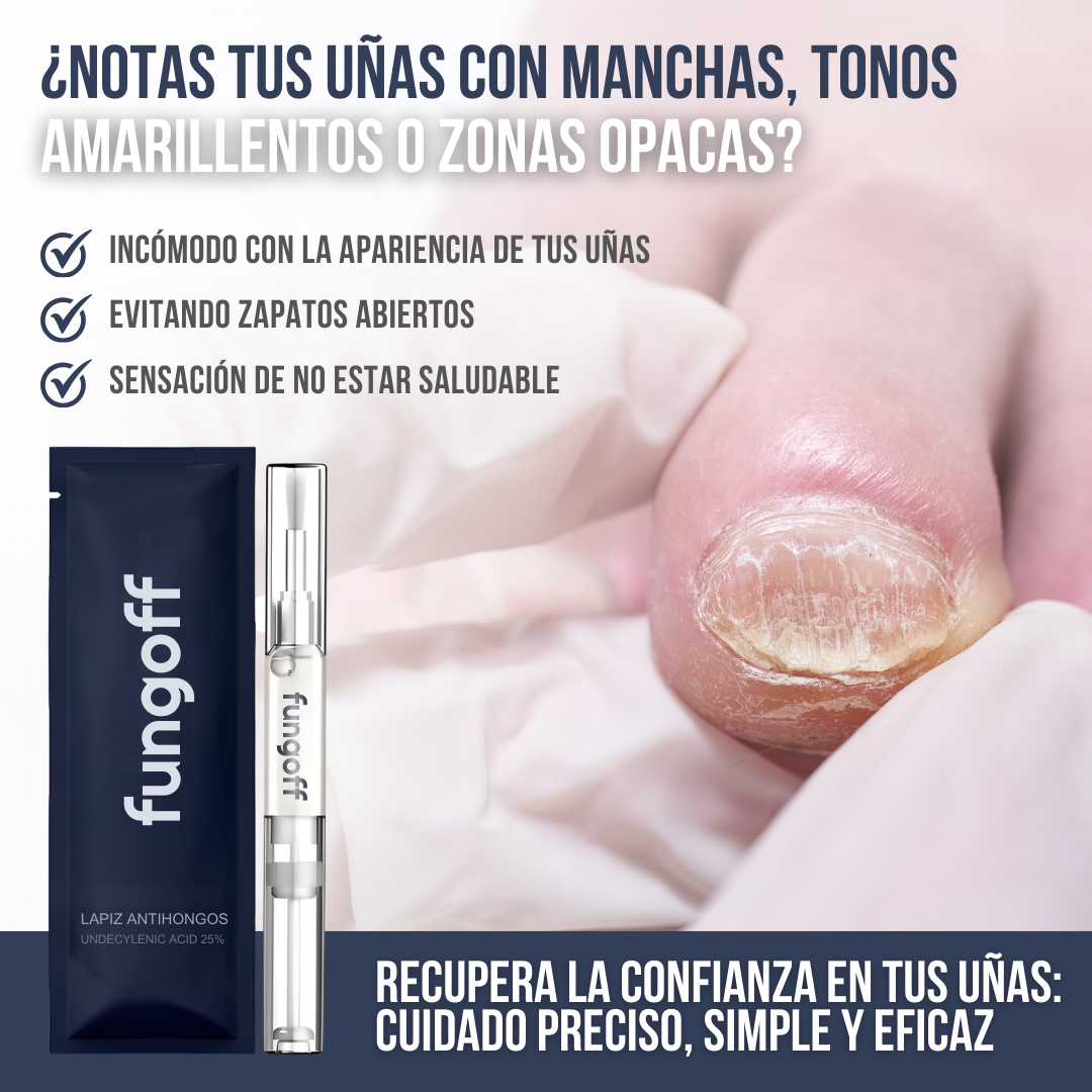 Fung Off™ – Precisión directa para uñas más sanas