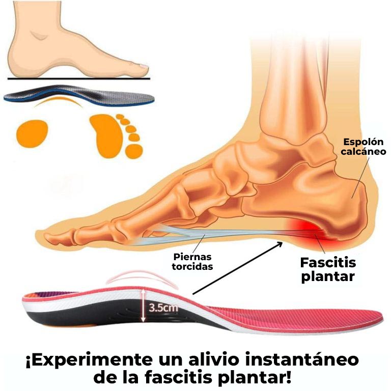ArchAngel™ - Plantillas ortopédicas de arco alto