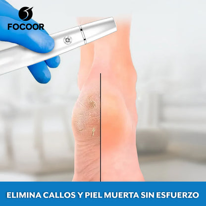 Focoor™ – Removedor de callos FAF para cuidado profesional en casa