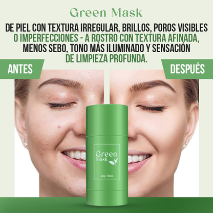 Green Mask™ — Piel limpia, calmada y luminosa en instantes