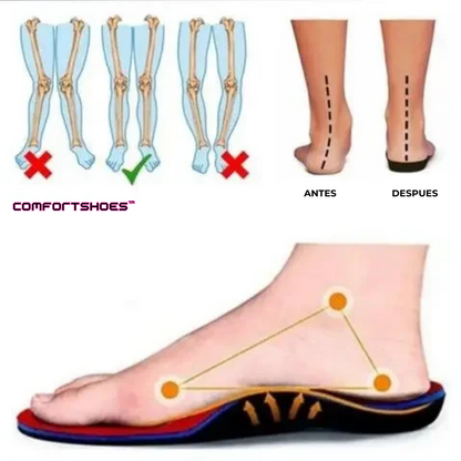ComfortShoes™ - Zapatos Mocasines Correctivos